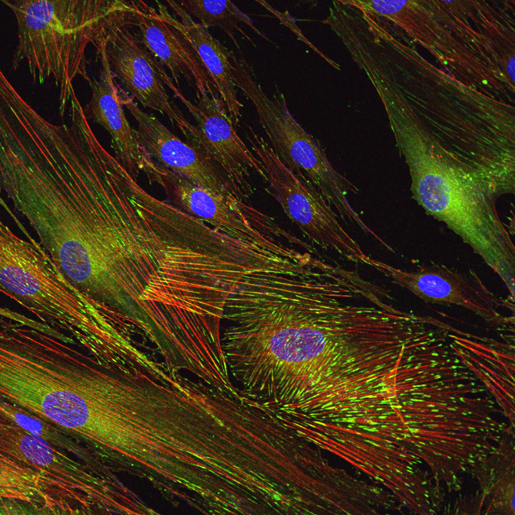 An image of trabecular meshwork cells, which play a critical role in regulating intraocular pressure, taken by the laboratory of David J. Krizaj, PhD.